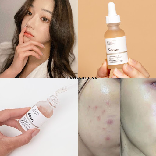 سرم لاکتیک اسید 10% +HA لایه بردار و روشن کننده پوست اوردینری 30 میل