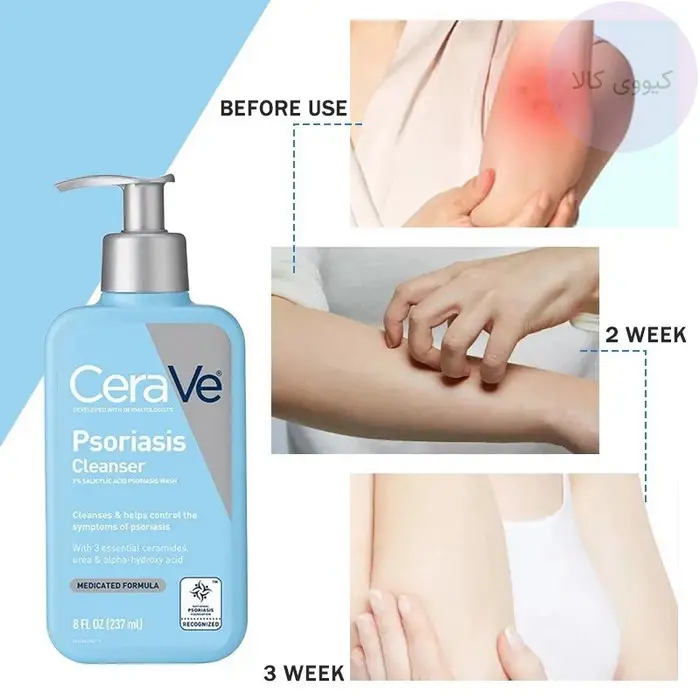 ژل شستشو سراوی مدل Psoriasis Cleanser حجم 237 میل